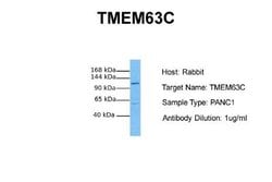 TMEM63C Rabbit anti-Human, Polyclonal, Novus Biologicals 0.1 mL | Buy Online | Novus Biologicals | Fisher Scientific